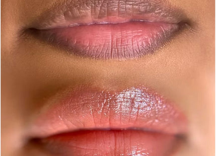 Lip Pigmentation Treatment